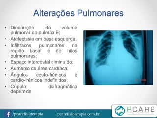 pcarefisioterapia.com.br/pcarefisioterapia
Alterações Pulmonares
• Diminuição do volume
pulmonar do pulmão E;
• Atelectasia em base esquerda,
• Infiltrados pulmonares na
região basal e de hilos
pulmonares;
• Espaço intercostal diminuído;
• Aumento da área cardíaca;
• Ângulos costo-frênicos e
cardio-frênicos indefinidos;
• Cúpula diafragmática
deprimida
 