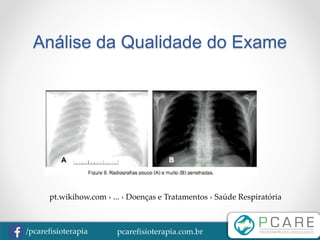 pcarefisioterapia.com.br/pcarefisioterapia
Análise da Qualidade do Exame
pt.wikihow.com › ... › Doenças e Tratamentos › Saúde Respiratória
 