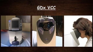 GDx VCC
 