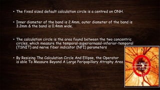 • The fixed sized default calculation circle is a centred on ONH.
• Inner diameter of the band is 2.4mm, outer diameter of the band is
3.2mm & the band is 0.4mm wide.
• The calculation circle is the area found between the two concentric
circles, which measure the temporal-superiornasal-inferior-temporal
(TSNIT) and nerve fiber indicator (NFI) parameters
• By Resizing The Calculation Circle And Ellipse, the Operator
is able To Measure Beyond A Large Peripapillary Atrophy Area
 