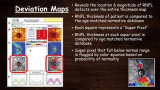 Deviation Maps
• Reveals the location & magnitude of RNFL
defects over the entire thickness map
• RNFL thickness of patient is compared to
the age-matched normative database
• Each square represents a “Super Pixel”
• RNFL thickness at each super pixel is
compared to age matched normative
database
• Super pixel that fall below normal range
is flagged by color squares based on
probability of normality
 