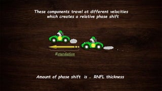 These components travel at different velocities
which creates a relative phase shift
2
Retardation
1
Amount of phase shift is ≃ RNFL thickness
 