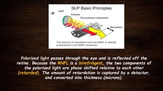 Polarized light passes through the eye and is reflected off the
retina. Because the RNFL is a birefringent, the two components of
the polarized light are phase shifted relative to each other
(retarded). The amount of retardation is captured by a detector,
and converted into thickness (microns).
 