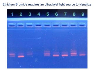 Ethidium Bromide requires an ultraviolet light source to visualize
 
