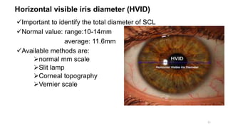 Horizontal visible iris diameter (HVID)
Important to identify the total diameter of SCL
Normal value: range:10-14mm
average: 11.6mm
Available methods are:
normal mm scale
Slit lamp
Corneal topography
Vernier scale
11
 