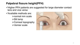 Palpebral fissure height(PFH)
Higher PFH patients are suggested for large diameter contact
lens and vice versa
Available methods are:
normal mm scale
Slit lamp
Corneal topography
Vernier scale
12
 