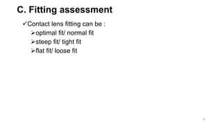C. Fitting assessment
Contact lens fitting can be :
optimal fit/ normal fit
steep fit/ tight fit
flat fit/ loose fit
19
 