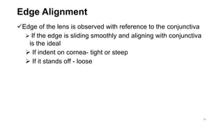 Edge Alignment
Edge of the lens is observed with reference to the conjunctiva
 If the edge is sliding smoothly and aligning with conjunctiva
is the ideal
 If indent on cornea- tight or steep
 If it stands off - loose
26
 
