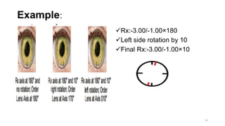 Example:
Rx:-3.00/-1.00×180
Left side rotation by 10
Final Rx:-3.00/-1.00×10
35
 