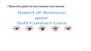 Show the patient on lens insertion and removal
41
 
