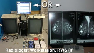 Radiologist Workstation, RWS (if applicable)

 