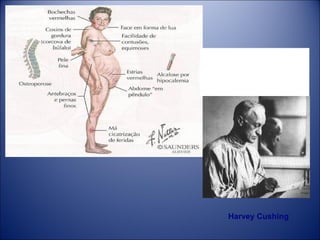 Epônimo da Medicina é
uma personalidade Cientifica ou
Lendária  que dá, ou empresta, o
seu nome  a alguma coisa, Patologia
Instrumento etc.

Harvey Cushing

 