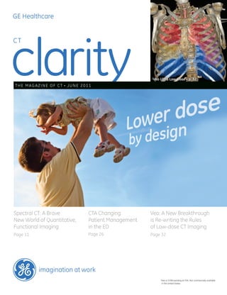 GE Healthcare




clarity
CT




                                                      §
                                                          Veo Ultra Low Dose – p. 32
THE MAGAzINE oF CT   •   JuNE 2011




Spectral CT: A Brave             CTA Changing         Veo: A New Breakthrough
New World of Quantitative,       Patient Management   is Re-writing the Rules
Functional Imaging               in the ED            of Low-dose CT Imaging
Page 11                          Page 26              Page 32




          imagination at work
                                                              §
                                                               Veo is 510(k) pending at FDA. Not commercially available
                                                               in the united States.
 