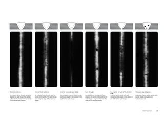 Weld Inspection 23 
External undercut. 
An irregular darker density along the 
edge of the weld image. The density 
will always be darker than the density 
of the pieces being welded. 
Incomplete - or Lack of Penetration 
(LoP). 
A darker density band, with very 
straight parallel edges, in the center of 
the width of the weld image. 
Internal (root) undercut. 
An irregular darker density near the 
centre of the width of the weld image 
and along the edge of the root pass 
image. 
Interpass slag inclusions. 
Irregularly-shaped darker density spot, 
usually slightly elongated and 
randomly spaced. 
Internal concavity (suck back). 
An elongated irregular darker density 
with fuzzy edges, in the vcentre of the 
width of the weld image. 
Burn through. 
Localized darker density with fuzzy 
edges in the centre of the width of the 
weld image. It may be wider than the 
width of the root pass image. 
 