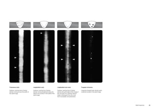 Weld Inspection 25 
Transverse crack. 
Feathery, twisting lines of darker 
density running across the width of 
the weld image. 
Longitudinal crack. 
Feathery, twisting line of darker 
density running lengthwise along the 
weld at any location in the width of the 
weld image. 
Longitudinal root crack. 
Feathery, twisting lines of darker 
density along the edge of the image of 
the root pass The “twisting” feature 
helps to distinguish the root crack 
from incomplete root penetration. 
Tungsten inclusions. 
Irregularly shaped lower density spots 
randomly located in the weld image. 
