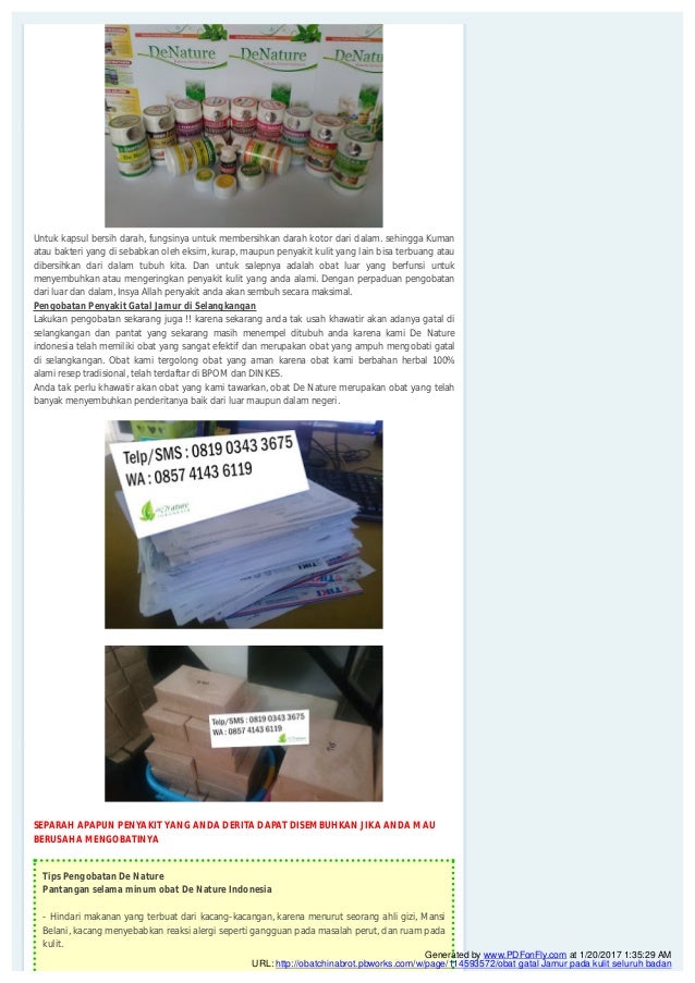 Gejala gatal jamur dan cara mengobatinya