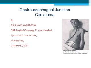 Gastro-esophageal Junction
Carcinoma
By
DR.BHAVIN VADODARIYA
DNB Surgical Oncology 1st year Resident,
Apollo CBCC Cancer Care,
Ahmedabad,
Date-02/12/2017
 