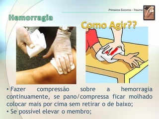 • Fazer compressão sobre a hemorragia
continuamente, se pano/compressa ficar molhado
colocar mais por cima sem retirar o de baixo;
• Se possível elevar o membro;
Primeiros Socorros - Trauma
 