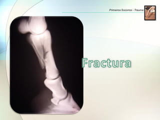 Primeiros Socorros - Trauma
 