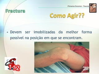 • Devem ser imobilizadas da melhor forma
possível na posição em que se encontram.
Primeiros Socorros - Trauma
 