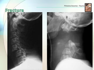 Primeiros Socorros - Trauma
 