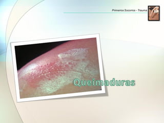 Primeiros Socorros - Trauma
 
