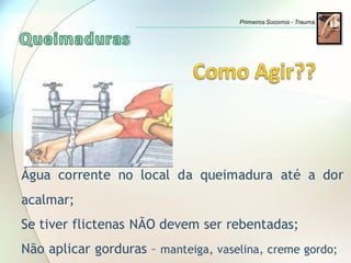 Água corrente no local da queimadura até a dor
acalmar;
Se tiver flictenas NÃO devem ser rebentadas;
Não aplicar gorduras – manteiga, vaselina, creme gordo;
Primeiros Socorros - Trauma
 