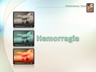 Primeiros Socorros - Trauma
 