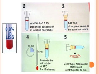 Gel card technology ppt nc | PPTX
