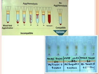 Gel card technology ppt nc | PPTX