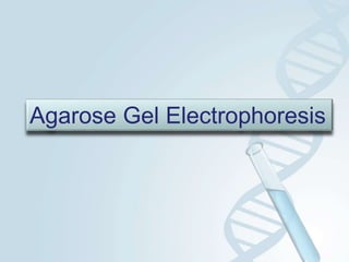 Agarose Gel Electrophoresis
 