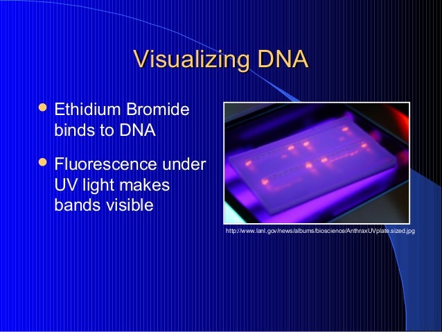  Gel electrophoresis 08