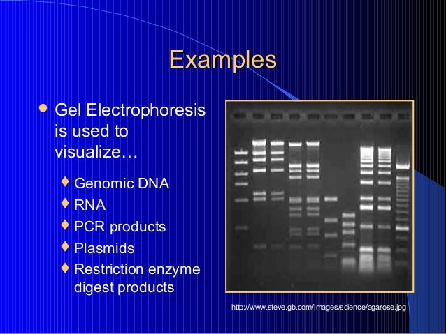 matrix band size Gel electrophoresis 08 matrix band size Gel electrophoresis 08