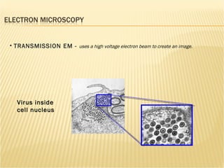 TRANSMISSION EM -  uses a high voltage electron beam to create an image. Virus inside cell nucleus 