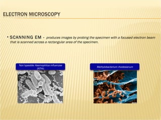 SCANNING EM -  produces images by probing the specimen with a focused electron beam that is scanned across a rectangular area of the specimen.  Non typeable  Haemophilus influenzae  (NTHi) Methylobacterium rhodesianum 