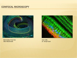 Mammalian Inner Ear Glen MacDonald Hair Cells Dr. Sonja Pyott 