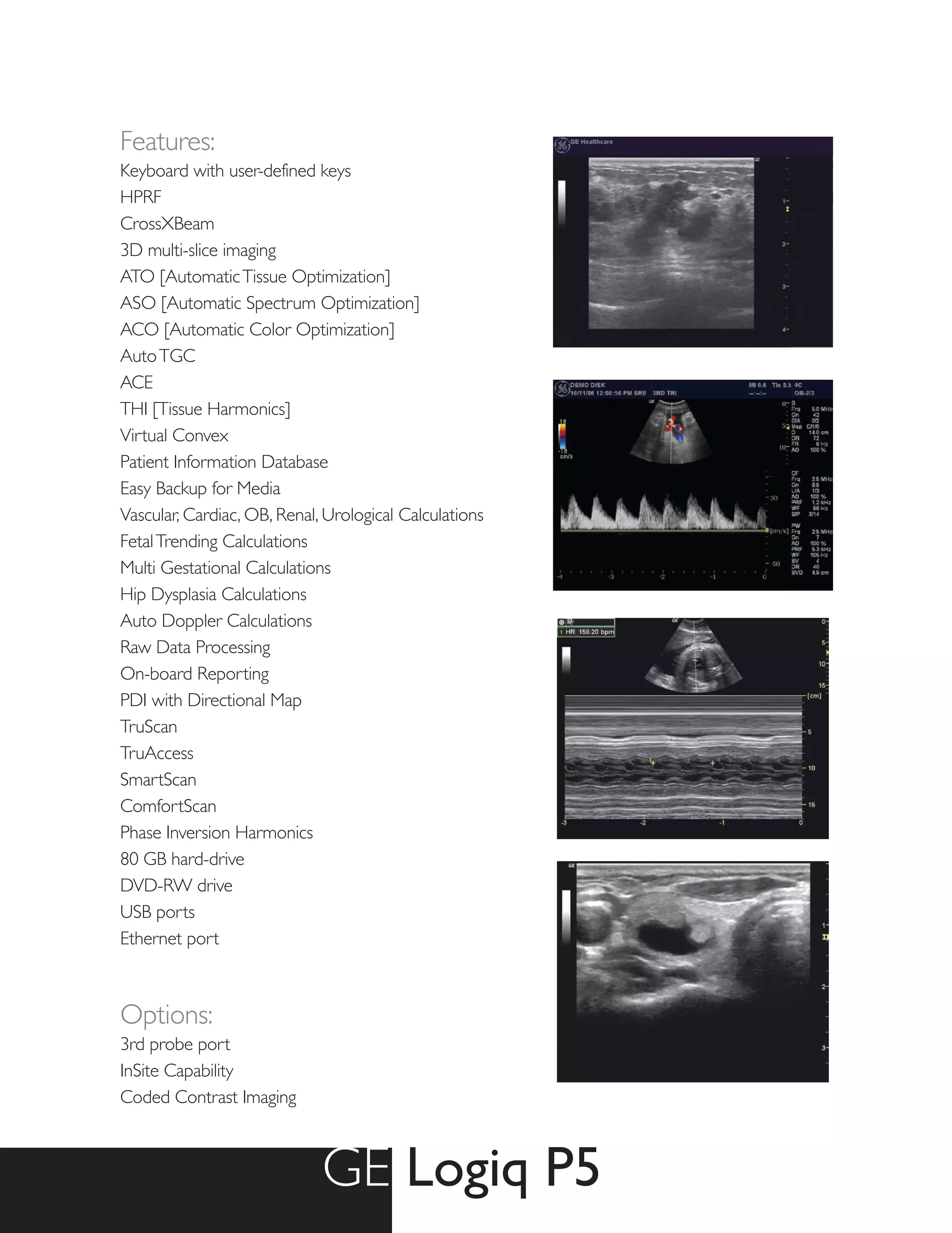 Features:
Keyboard with user-defined keys
HPRF
CrossXBeam
3D multi-slice imaging
ATO [Automatic Tissue Optimization]
ASO [Automatic Spectrum Optimization]
ACO [Automatic Color Optimization]
Auto TGC
ACE
THI [Tissue Harmonics]
Virtual Convex
Patient Information Database
Easy Backup for Media
Vascular, Cardiac, OB, Renal, Urological Calculations
Fetal Trending Calculations
Multi Gestational Calculations
Hip Dysplasia Calculations
Auto Doppler Calculations
Raw Data Processing
On-board Reporting
PDI with Directional Map
TruScan
TruAccess
SmartScan
ComfortScan
Phase Inversion Harmonics
80 GB hard-drive
DVD-RW drive
USB ports
Ethernet port



Options:
3rd probe port
InSite Capability
Coded Contrast Imaging



                             GE Logiq P5
 
