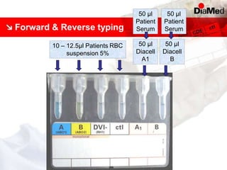 Forward & Reverse typing
50 µl
Diacell
A1
50 µl
Diacell
B
50 µl
Patient
Serum
50 µl
Patient
Serum
10 – 12.5µl Patients RBC
suspension 5%
 