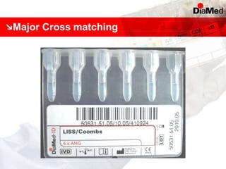 Major Cross matching
 