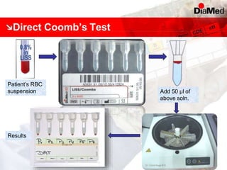 Direct Coomb’s Test
Patient’s RBC
suspension Add 50 µl of
above soln.
Results
 