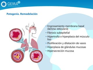 • Engrosamiento membrana basal
(lámina reticularis)
• Fibrosis subepitelial
• Hipertrofia e hiperplasia del músculo
liso
• Proliferación y dilatación de vasos
• Hiperplasia de glándulas mucosas
• Hipersecreción mucosa
Patogenia. Remodelación
 