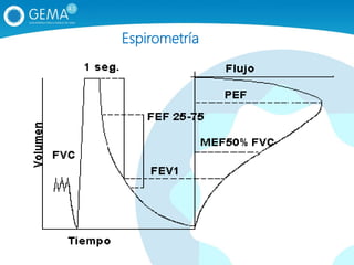 Espirometría
 