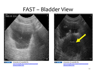 Fast Bladder GEMC - Medical Student - Trauma - Initial Assessment and Management of ...