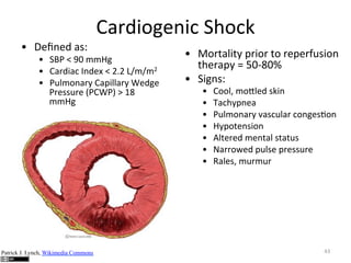 B  0'12'D"7+b"

>75D3.;'23(",-.(/"

B  ,K9"m"]c"66Q;"
B  >75D37("C2D'G"m"#l#"if6f6#"
B  9F86.275:">7=38875:"Z'D;'"
95'++F5'"W9>Z9X"o"!U"
66Q;"

Patrick J. Lynch, Wikimedia Commons

B  ^.5<783<:"=53.5"<."5'='5@F+3.2"
<-'57=:"L"PcYUcp"
B  ,3;2+b"
B 
B 
B 
B 
B 
B 
B 

>..8R"6._8'D"+/32"
?7(-:=2'7"
9F86.275:"*7+(F875"(.2;'+).2""
Q:=.<'2+3.2"
e8<'5'D"6'2<78"+<7<F+"
4755.I'D"=F8+'"=5'++F5'"
H78'+R"6F56F5"

JA"

 