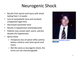 4'F5.;'23(",-.(/"
•  H'+F8<+"@5.6"+=3278"(.5D"32&F5:"I3<-"+-.(/"
87+)2;"@5.6"!YA"I''/+"
•  i.++".@"+:6=7<-')("<.2'"72D"5'+F8<72<"
F2.==.+'D"*7;78"<.2'"
•  0'(5'7+'D"*7+.6.<.5"<.2'""
•  H'+F8<+"32"-:=.<'2+3.2"72D"%57D:(75D37"
•  97)'2<+"67:"5'6732"78'5<R"I756R"72D"D5:"
D'+=3<'"<-'"-:=.<'2+3.2"
•  ,=3278"+-.(/"
–  ?'6=.575:"8.++".@"+=3278"5''G"7()*3<:"
%'8.I"7"<.<78".5"2'75"<.<78"+=3278"(.5D"
32&F5:"
–  4.<"<-'"+76'"7+"2'F5.;'23("+-.(/R"<-'"
<'56+"75'"2.<"32<'5(-72;'7%8'"

gunkyboy, Wikimedia Commons

J]"

 