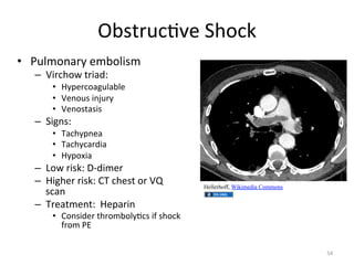 $%+<5F()*'",-.(/"
•  9F86.275:"'6%.83+6"
–  N35(-.I"<537Db""

•  Q:='5(.7;F87%8'"
•  N'2.F+"32&F5:"
•  N'2.+<7+3+"

–  ,3;2+b""

•  ?7(-:=2'7""
•  ?7(-:(75D37"
•  Q:=.G37"

–  i.I"53+/b"0YD36'5"
–  Q3;-'5"53+/b">?"(-'+<".5"Nk"
+(72"
–  ?5'7<6'2<b""Q'=7532"

Hellerhoff, Wikimedia Commons

•  >.2+3D'5"<-5.6%.8:)(+"3@"+-.(/"
@5.6"9V"
PJ"

 