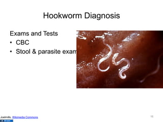 Hookworm Diagnosis
Exams and Tests
•  CBC
•  Stool & parasite exam

Joelmills, Wikimedia Commons

16

 