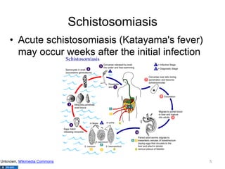 Schistosomiasis
•  Acute schistosomiasis (Katayama's fever)
may occur weeks after the initial infection

Unknown, Wikimedia Commons

5

 
