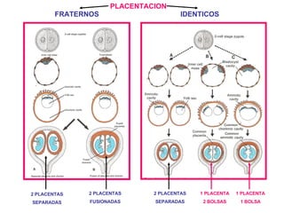   PLACENTACION    FRATERNOS  IDENTICOS 2 PLACENTAS SEPARADAS 2 PLACENTAS FUSIONADAS 2 PLACENTAS SEPARADAS 1 PLACENTA 2 BOLSAS 1 PLACENTA 1 BOLSA 