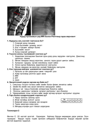 Нуруу нугаламын үед MRI болон Рентгенд гарах өөрчлөлт
1. Нурууны аль хэсгийг гэмтээсэн бэ?
1. Сээрний доод түвшинд
2. Сээр бүсэлхийн уулзвар хэсэгт
3. Аль ч түвшинг хамарч болно
4. Бүсэлхийн хэсэгт
5. Хүзүү сээрний уулзварт.
2. Үзүүлэх анхны тусламжийг сонгоно уу?
1. Хөдөлгөөн хязгаарлаж банзтай орон дээр дээш харуулан хэвтүүлнэ. Давсганд
шээлгүүр тавина.
2. Өвчин намдаах эмүүд хэрэглэж, шокоос гарах дусал шингэн хийнэ.
3. Хугарсан нурууны орчим новойканы хориг хийнэ
4. Хагас суугаа байрлалд хөдөлгөөнгүй хэвтүүлнэ
5. Өвчин намдаах эм хэрэглэж мэлхий байрлалд хэвтүүлнэ
3. Нэн түрүүнд хийгдэх шинжилгээг сонгоно уу?
1. Нугасны ус авч дарагдлын шинж тэмдгийг үзнэ
2. Хоёр тусгалаар рентген зураг авна
3. MRI
4. КТГ
5. ЭХО
4. Эмчилгээний үндсэн зарчим юу байх вэ?
1. Гильсоны гогцоот татлага хийж эмийн болон физик эмчилгээ хийнэ
2. Эвийн ба эмийн мэс засал эмчилгээ хавсруулан хийнэ
3. Шанцын чиг тавьж Халогийн аппаратаар бэхэлгээ хийнэ
4. Нугасны дарагдлыг чөлөөлж хугарал мултралыг засч бэхэлнэ
5. Чамархайнаас ясны татлага хийж эвийн аргаар хугарал мултралыг оруулна.
5. Гарч болох хүндрэлүүдийг нэрлэнэ үү?
1. Нуруу нугасны шоконд орох
2. Өгзөг өсгийнд холголт үүсэх
3. Бөөрний замын халдвар авч хүндрэх
4. Тархи хавагнаж комд орох
5. Мөчдөд атрофи үүсч тэжээл алдагдана
Тохиолдол 2
Өвчтөн С. 25 настай эрэгтэй . Барилдаж байгаад баруун мөрөөрөө дарж унасан. Зүүн
гараараа баруун гараа түшиж өргөсөн албадмал байрлалтай. Баруун мөрний орчим
өвчтэй хөдөлгөж чадахгүй.
№ 1 2 3 4 5
Хариу D A B C A
 